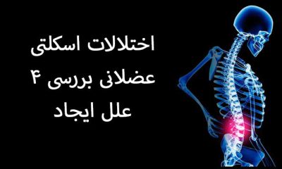 اختلالات اسکلتی عضلانی بررسی 4 علل ایجاد