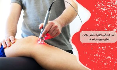 لیزر درمانی زخم 1 روشی نوین برای بهبود زخم‌ ها